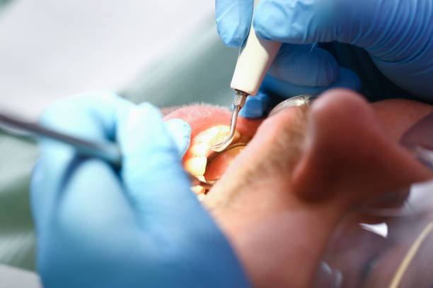 Best Emergency Root Canal Treatment in Nixon, PA