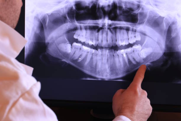 Best Emergency Tooth Extraction in Nixon, PA